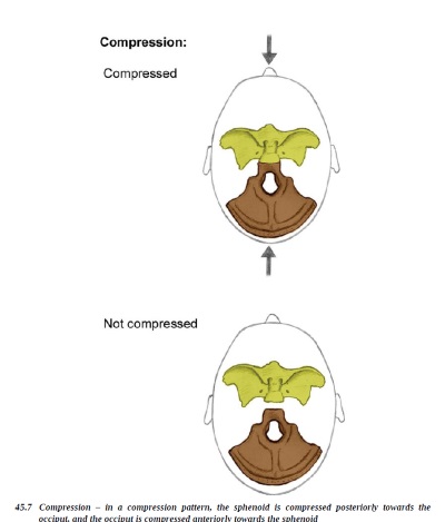 compression.jpg